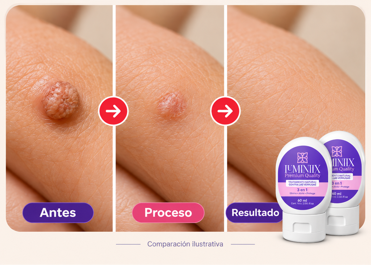 Kit Luminix® x2 | Cuidado para verrugas · 60 ml c/u